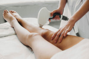 Epilation définitive